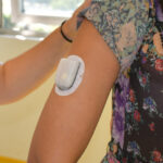 El hospital universitario Ramón y Cajal de Madrid emplea por primera vez en España un ‘sistema automatizado sin catéter’ para administrar insulina a adultos con diabetes tipo 1